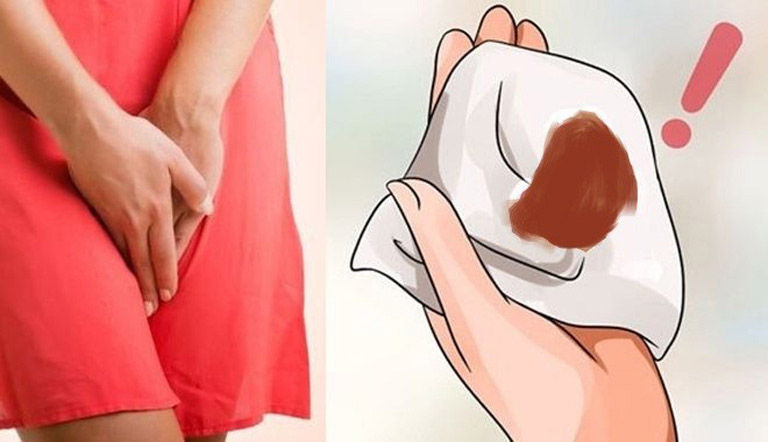 Vùng Kín Có Mùi Là Do Đâu Nguyên Nhân Và Cách Khắc Phục